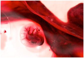 Bleeding portraits: Menstrual Artistic Inclinations and a means to pursue the artform